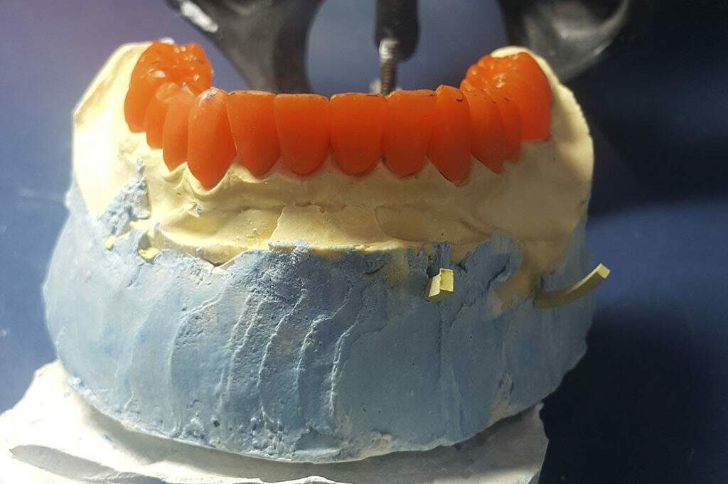 laboratorio protese dentaria equipe ddent