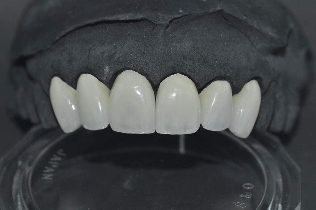laboratorio protese dentaria zona leste sp servicos ddent